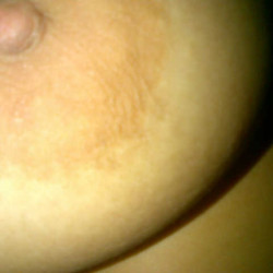Dientes
