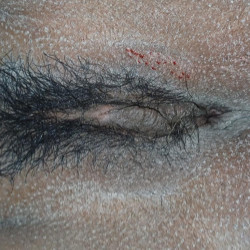 Pic #2 La enfermera 3