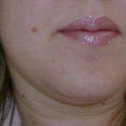 Pic #2 My sexy lips and toes.