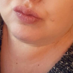 Pic #3 My sexy lips and toes.
